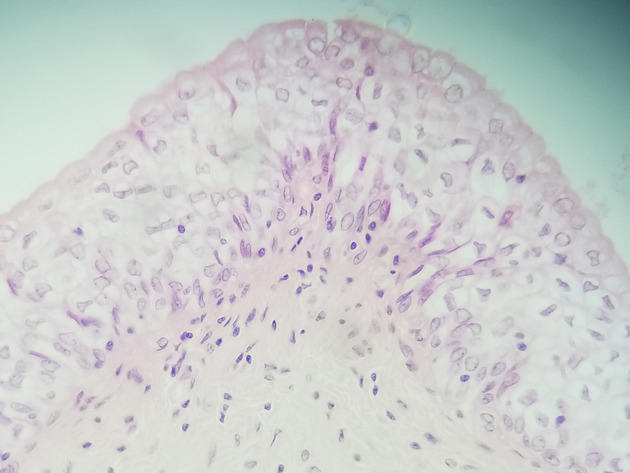 Transitional Epithelium Slides - Transitional Epithelium 09 400X